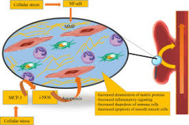 Ich will zu meinem vater gehn. Non Coding Rnas Role In Intracranial Aneurysm General Principles With Focus On Inflammation Sciencedirect