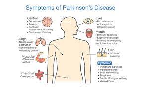 The history of parkinson's disease: Pcsuk Symptoms And Diagnosis Of Parkinson S Disease