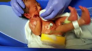 Giving a bed bath means washing someone who is in bed. How To Bathe Your Newborn Babys First Hospital Bath Video Dailymotion