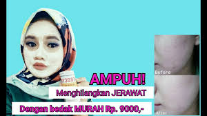 Ini selepas 2 hari , tieja konsisten. Beauty Journal Situs Kecantikan Dan Gaya Hidup Andalan Wanita Masa Kini