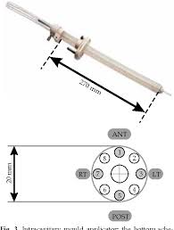 This portion of the guidelines focuses. Figure 3 From High Dose Rate Pre Operative Endorectal Brachytherapy For Patients With Rectal Cancer Semantic Scholar