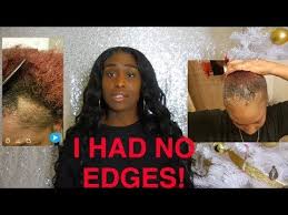 How To Grow Your Edges Back In 3 Weeks Black Hair Edges Grow Black Hair How To Grow Natural Hair