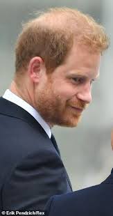 Prince Harry's hair is 'thinning on top ...