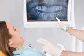 Your Guide To Becoming A Dental X-Rays.. - Jackson Dental