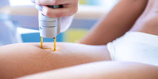 Is a canadian ipl beauty laser manufacturing company, with health canada approval. The 6 Best At Home Laser Hair Removal Devices How To Do Laser Hair Removal At Home