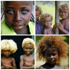 The gene variant responsible for blond hair in the islanders is distinctly different from the gene that. Flawless Kinky Curls The People Of Solomon Islands Known As