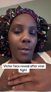 Victor Hek Face Reveal