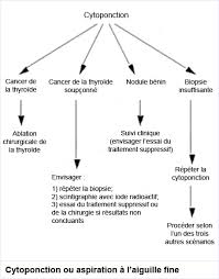 Un nodule thyroïdien est une petite grosseur généralement située au niveau du cou, dans la glande thyroïde. Maladies De La Thyroide Les Nodules Santecheznous Com