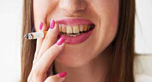 If the brown stains are caused by tartar or medical conditions, you should see a dentist. How To Remove Tobacco Nicotine Stains On Your Teeth Ismile Teeth Whitening Auckland Auckland Teeth Whitening