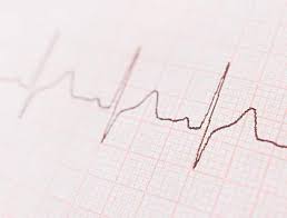How does an abnormal ecg effect a patient's preoperative evaluation? Ecg Abnormalities Warn Of Heart Related Risks In Older Women National Institutes Of Health Nih