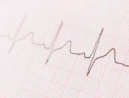 How does an abnormal ecg effect a patient's preoperative evaluation? Ecg Abnormalities Warn Of Heart Related Risks In Older Women National Institutes Of Health Nih