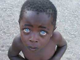 Typically, children with dark hair will keep their dark hair into adulthood. The Boy With The Sapphire Eyes Africa Geographic