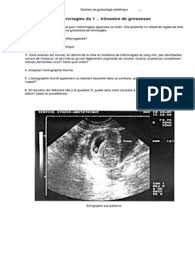 Généralement, les contractions sont de plus fortes intensités que quand elles sont naturelles. 800 Dossiers Medicaux Gyneco Grossesse Candidose