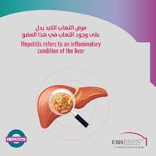 Pin On Hepatitis Awareness Month