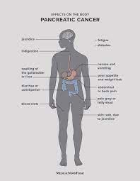 If your doctor thinks you may have pancreatic cancer, he or she may suggest the following tests: Pancreatic Cancer Symptoms Causes And Treatment