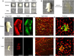 We did not find results for: 3d Microscopy And Deep Learning Reveal The Heterogeneity Of Crown Like Structure Microenvironments In Intact Adipose Tissue Science Advances