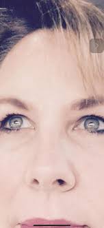 My eyes today would love to see others Central Heterochromia😊