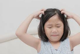 Image result for sores on the head in children
