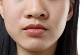Check spelling or type a new query. How To Fix Flared Nostrils The Face Experts
