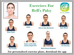 This in turn can lead to other issues, such as drooling or irritation of the eye, pain by the ear, and inability to taste. Healure On Twitter Exercises For Bell S Palsy Bellspalsy Stroke Parkinsons Physiotherapy