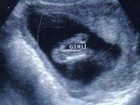 What Does A Baby Girl Look Like On Ultrasound