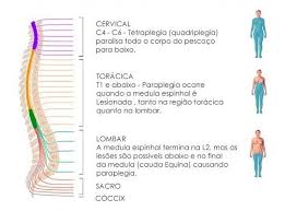 TRAUMA RAQUIMEDULAR E DIAGNOSTICO POR IMAGEM RESUMO ABSTRACT