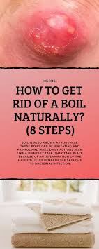 Boil Is Also Known As Furuncle These Boils Can Be Irritating And Painful And Make Daily Actions Seem Li Boil Remedies Cold Home Remedies Home Remedy For Boils