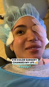 Eye Color Surgery Changed My Life 🥰