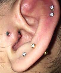 I Messed Up With My Tragus Piercing