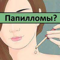 malosolnaya seledka v domashnih usloviyah recept zdorove pohudenie aptechka