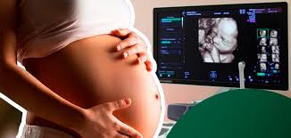 Pode consultar o significado de qualquer palavra abaixo com um clique. Ultrassom Na Gravidez Tudo O Que Voce Precisa Saber Medprev