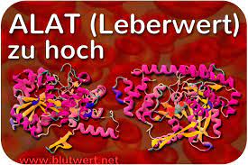 Laborwert Alat Alt Erhoht Zu Hoch