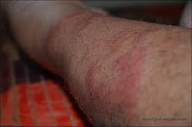 Namun seiring berkembangnya ilmu pengetahuan dan juga. Baru Baik Sakit Duacongkak S Spot