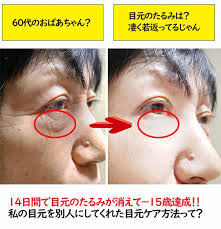 目のたるみ シワ クマが14日で消えた 50代女性が 15歳を達成した方法が凄すぎる belle nouvelles 目元 老け顔 シワ たるみ