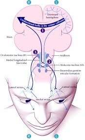 How Do The Eyes Move Together New Understandings Help Explain Eye Deviations In Patients With Stroke Medical Knowledge Brain Anatomy Pharmacology Nursing