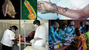 Nov 27, 2019 · quick take ebola virus disease therapeutics 01:49. Ohvmc8hm61 Tvm