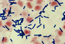 Classical foodborne intoxication due to clostridium botulinum. Clostridium Welchii Keyword Search Science Photo Library