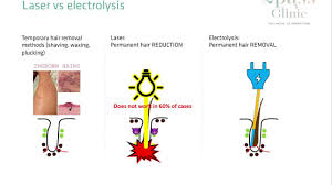 Frequently used hair removal methods and how they compare, contrast and complement electrolysis treatments. Electrolysis Vs Laser Hair Removal Which Should You Choose