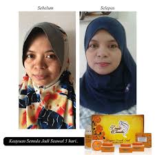Cara menggunakan foredi gel yang benar. Review Deeja Cosmetic Set Penjagaan Wajah 5 Dalam Satu
