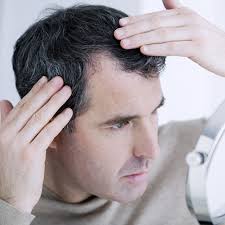 Alopecia can badly influence a female's psychological wellness and top quality of life. 5 Hair Loss Myths Brunet