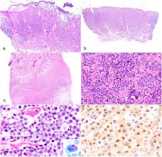 Image result for mastocytoma in dogs
