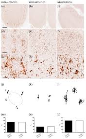 Rashid asari & co acted as legal adviser for pka in all the agreements mentioned in table 8 except for la pmu and qs4 agreement 1 and 2. Ijms Free Full Text Microglial Heterogeneity And Its Potential Role In Driving Phenotypic Diversity Of Alzheimer S Disease Html