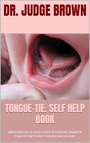 Image result for brown tongue symptoms
