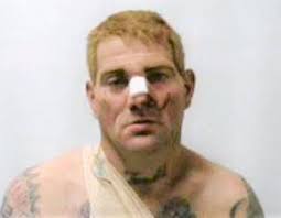 Fugitive allegedly injures deputy