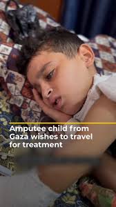 Video: Amputee child from Gaza wishes to travel for treatment
