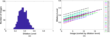 Effect Of Pupil Dilation On Off Angle Iris Recognition