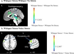 While it's easy to expressing what you're going through can be very cathartic, even if there's nothing you can do to alter the stressful situation. Limbic And Cortical Control Of Phonation For Speech In Response To A Public Speech Preparation Stressor Springerlink