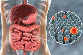 We did not find results for: Begini Akhirnya Hepatitis Bisa Jadi Kanker