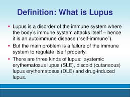 Learn about lupus symptoms like butterfly rash, joint pain and fatigue. Ppt Lupus Symptoms Diagnosis And Treatment Powerpoint Presentation Id 6810637