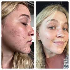 Reese Ruby Kendrick LME (@rubystateofskin) • Instagram photos and videos